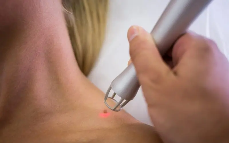 Skin Cancer & Skin Checks