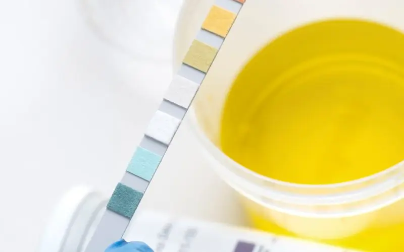 Urine Drug Screens