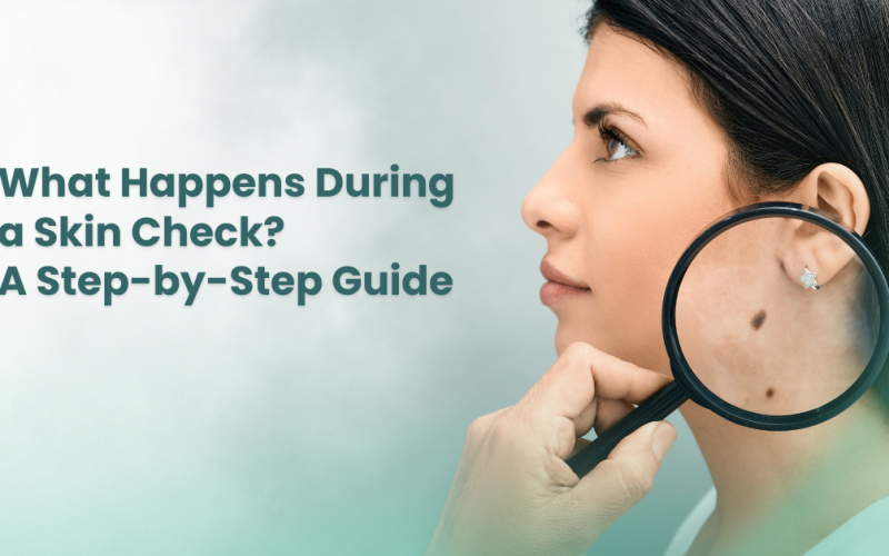 What Happens During a Skin Check? A Step-by-Step Guide
